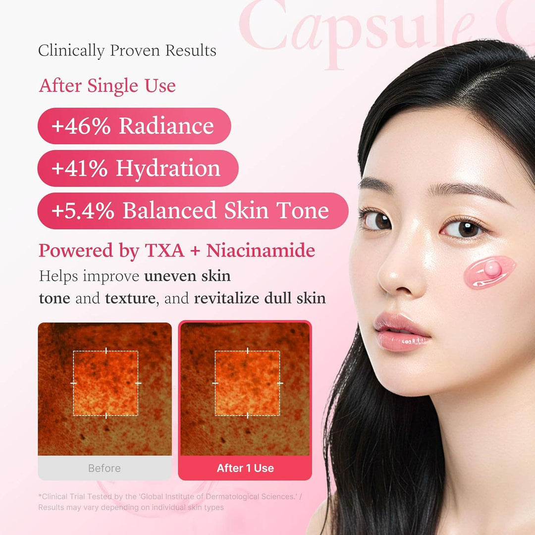 TXA capsule cream