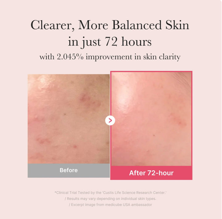 Txa serum