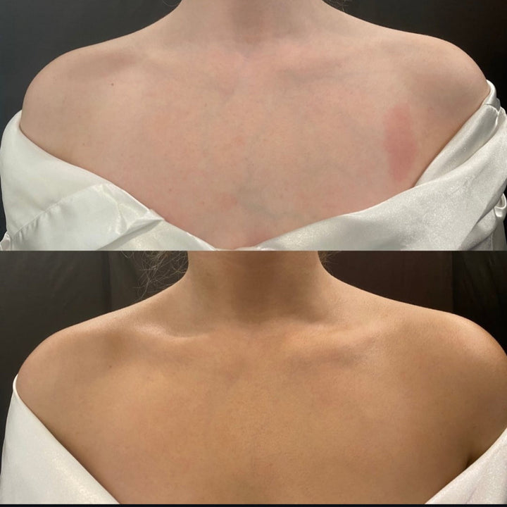 Before and after image of a spray tan treatment showing a natural bronzed skin tone.